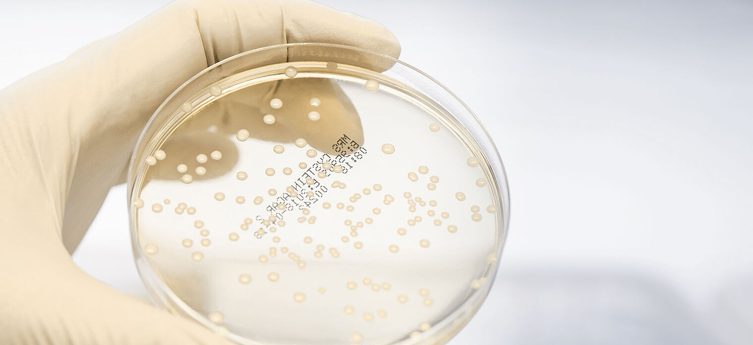 Gloved hand holding a petri dish with bacterial colonies growing on the surface, used for scientific research.